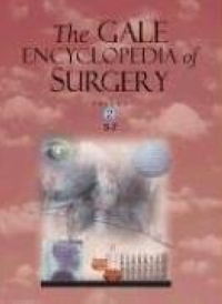 The Gale Encyclopedia of Surgery: A Guide for Patients and Caregivers